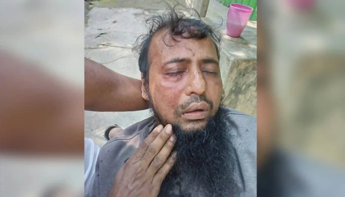 জামায়াত কর্মীকে হামলার অভিযোগ যুবদল কর্মীর বিরুদ্ধে