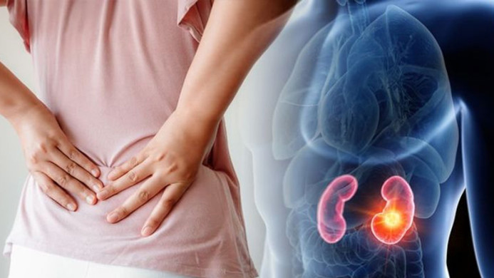 কিডনি খারাপের ৫ লক্ষণ চোখে দেয় আগাম সতর্কবার্তা