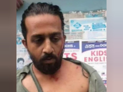 গণ বিশ্ববিদ্যালয়ের শিক্ষার্থীর ওপর সহপাঠীর হামলার অভিযোগ