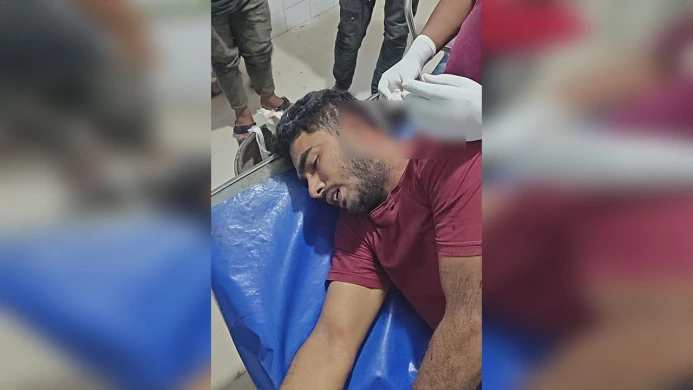 রাজবাড়ীতে সংবাদ সংগ্রহে গিয়ে হামলার শিকার সাংবাদিক