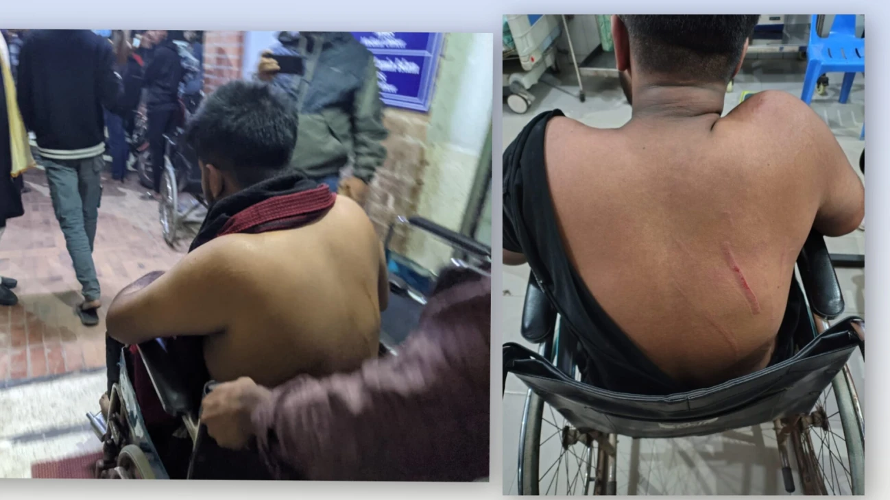 গণ বিশ্ববিদ্যালয়ের গকসু'র কার্যনির্বাহী সদস্য ক্যাম্পাসে দূর্বৃত্তের হামলার শিকার