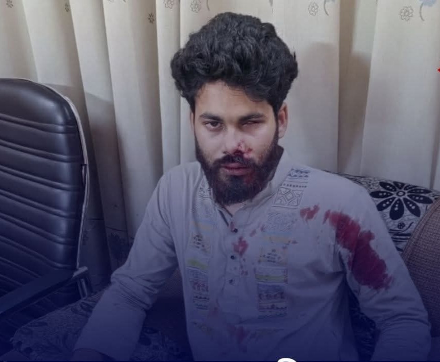 বাগছাসের কেন্দ্রীয় সদস্য হৃদয়ের উপর ডেমরা থানা ছাত্রদল সভাপতির নেতৃত্বে হামলা