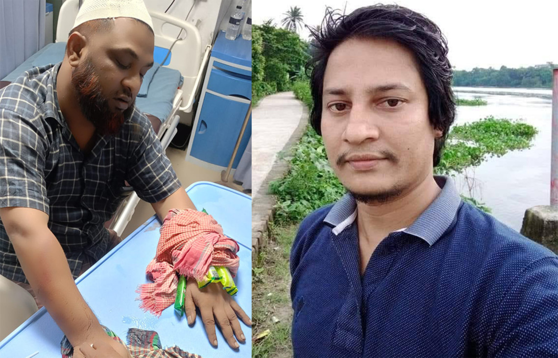 চাঁদা না পেয়ে ব্যবসায়ীর দুই হাত ভেঙ্গে দিলেন যুবদল নেতা শ্যুটার শফিক